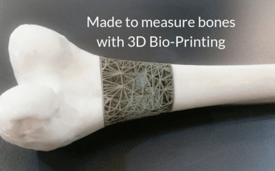 Stryker, J&J bet on medical tech uses of 3D printing